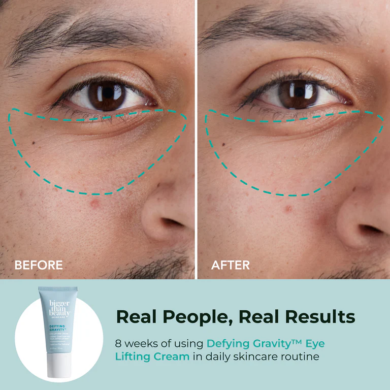 Defying Gravity™ Eye Lifting Cream