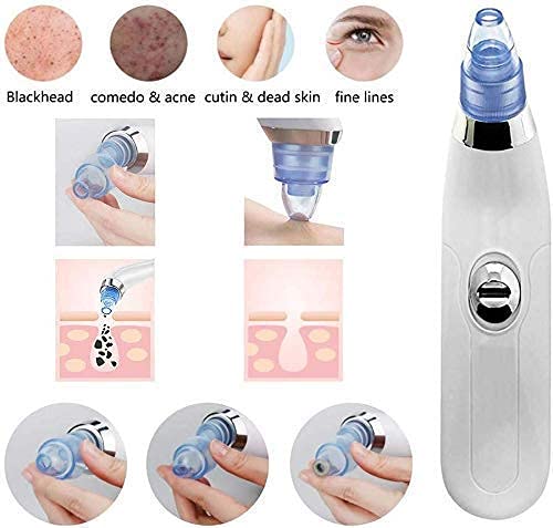 BINSBARRY Blackhead Remover, Beautiful Skin Care Expert Acne Pore Cleaner Vacuum Blackhead Remover Kit Skin Cleaner, Pimple Removal Tool